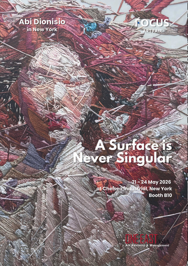 A Surface is Never Singular